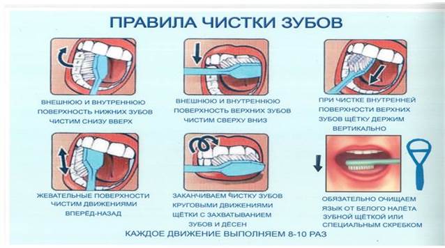 правила чистки зубов.jpg